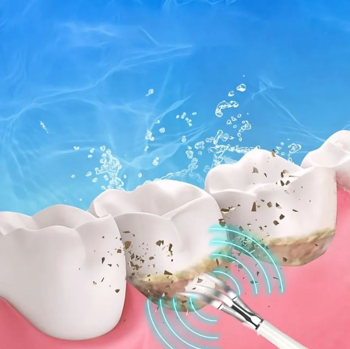 6-in-1 Ultrasonic Teeth Cleaner & Scaler