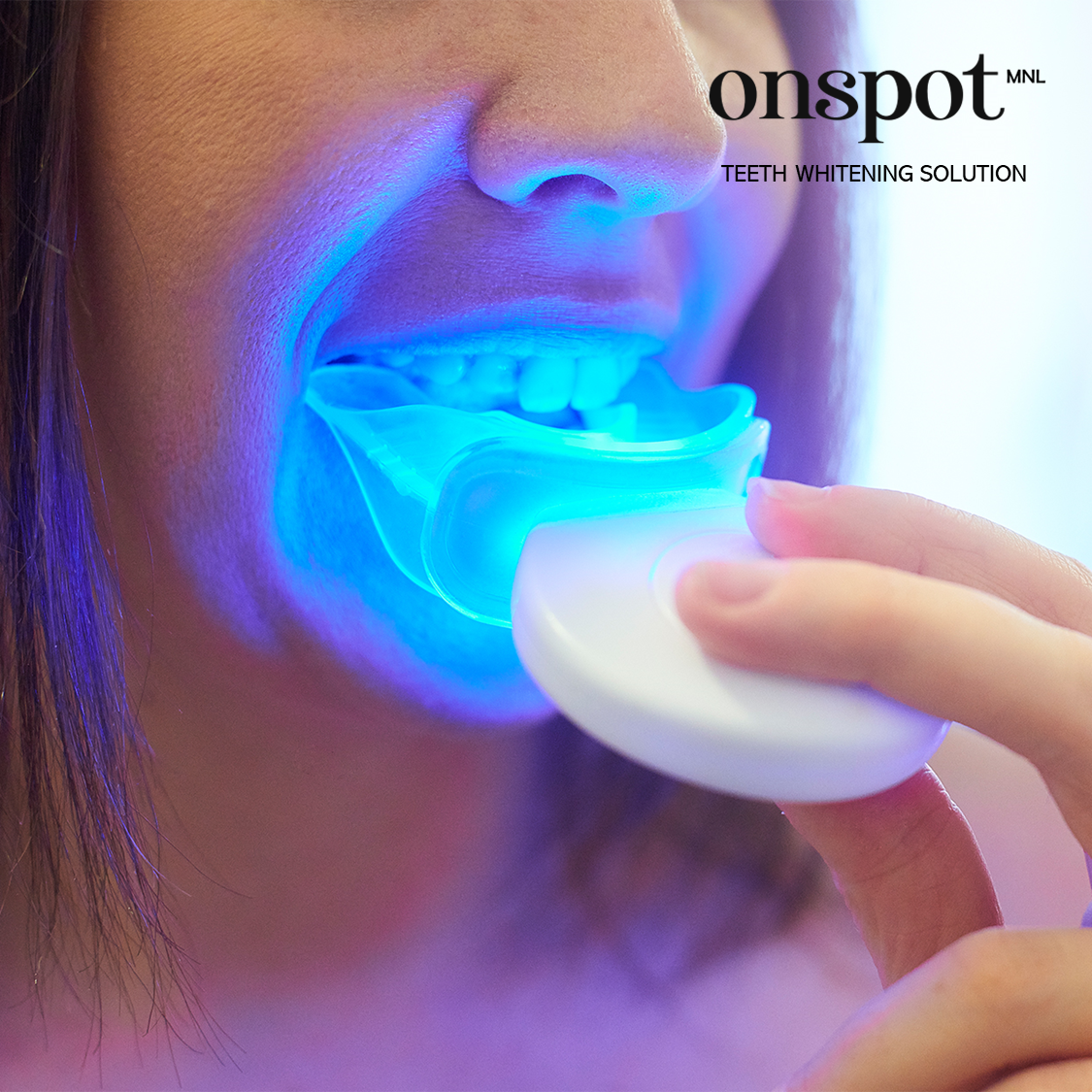 Advance Teeth Whitening Solution